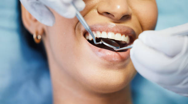 Best Lost Filling or Crown Replacement in Robinson, TX